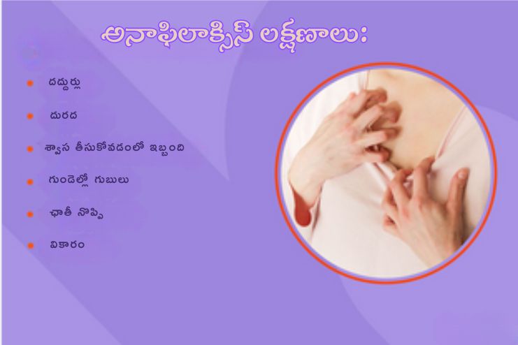 Frequent Symptoms of Anaphylaxis