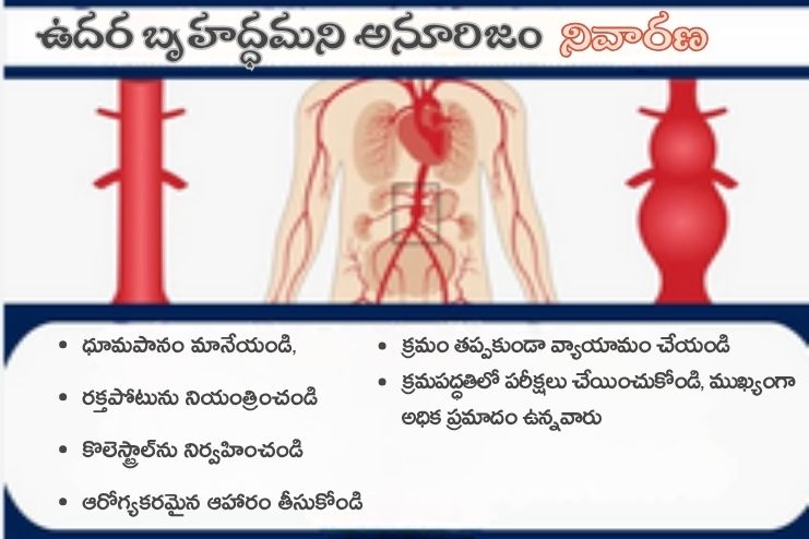 Prevention of Abdominal Aortic Aneurysm