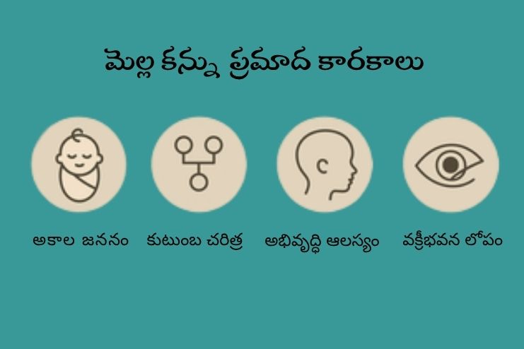 Risk factors for Lazy eye