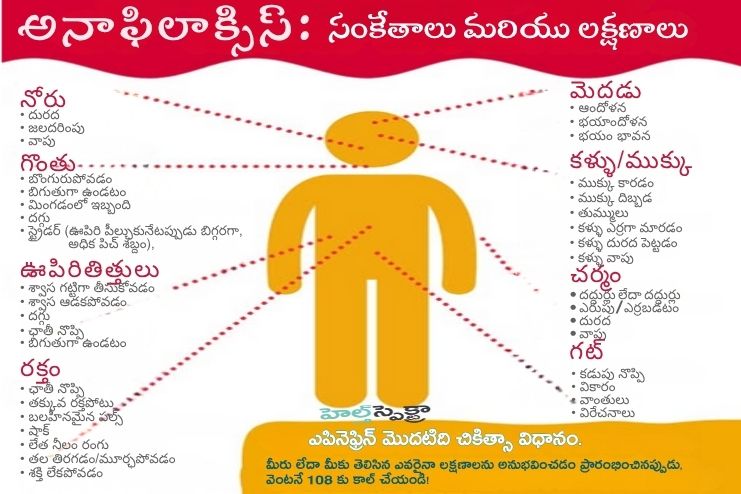 Signs and symptoms of anaphylaxis