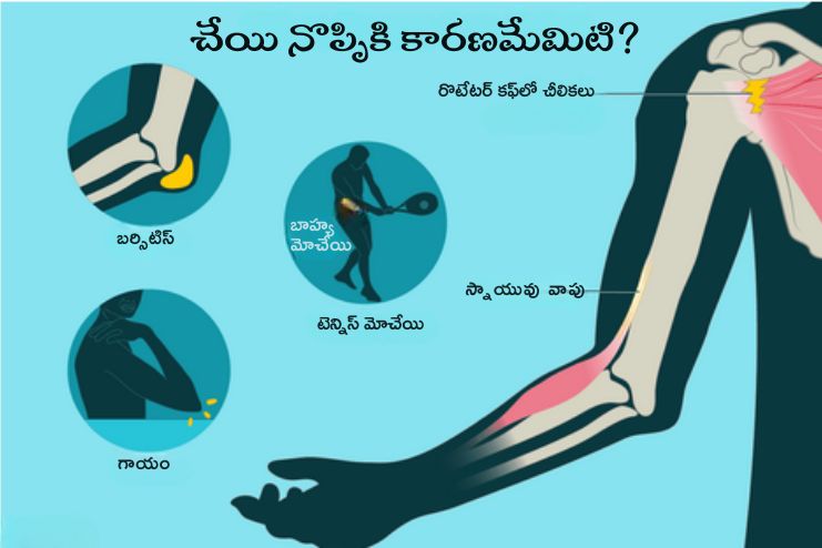 Skeletomuscular injury