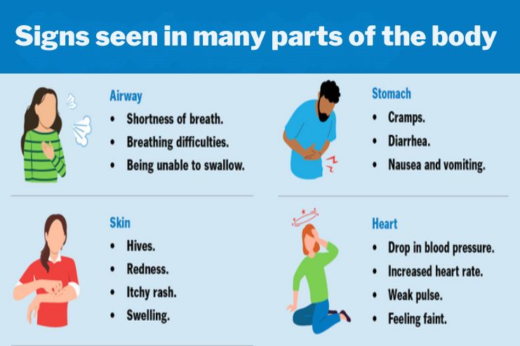 Symptoms seen in many parts of the body