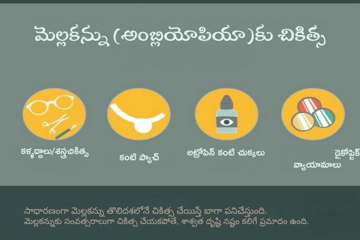 Treatment for Lazy eye