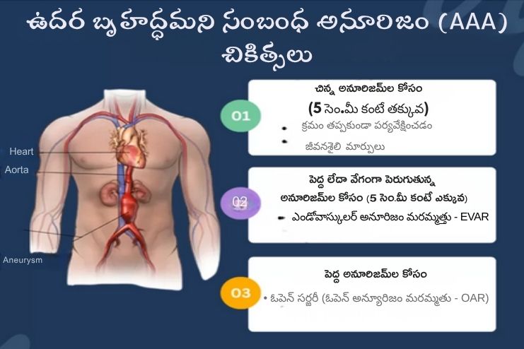 Treatment of Abdominal aortic aneurysm