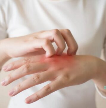 శీతాకాలపు అలర్జీలు ఏమిటీ? వాటిని ఎలా నిరోధించాలి.? What are winter allergies_How to prevent them