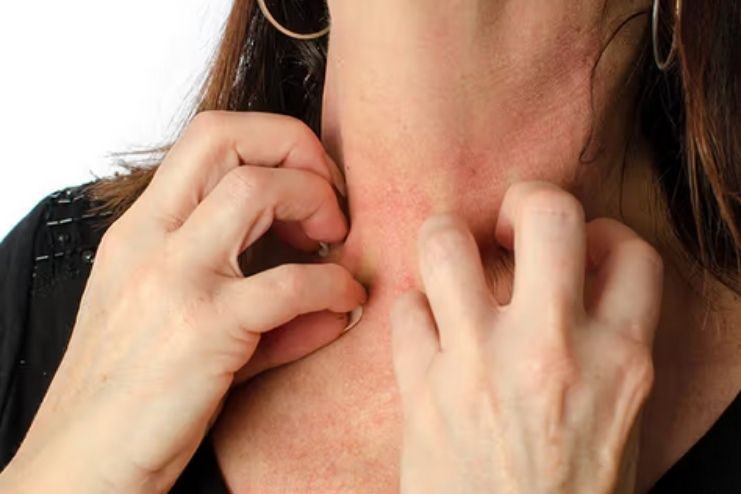 What happens in anaphylaxis