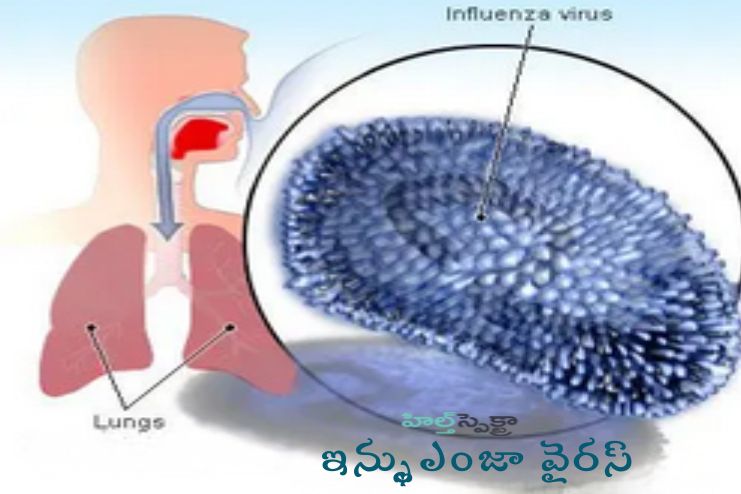 influenza