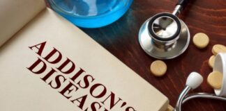 అడిసన్ వ్యాధి: లక్షణాలు, కారణాలు, రోగ నిర్ధారణ మరియు చికిత్స - Addison's disease: symptoms, causes, diagnosis and treatment Addison's disease