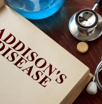 అడిసన్ వ్యాధి: లక్షణాలు, కారణాలు, రోగ నిర్ధారణ మరియు చికిత్స Addison's disease