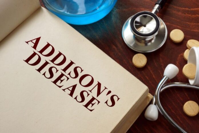 Addison's disease