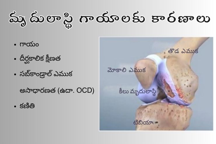 Causes of Cartilage Injuries