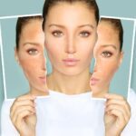 Curd benefits for skin