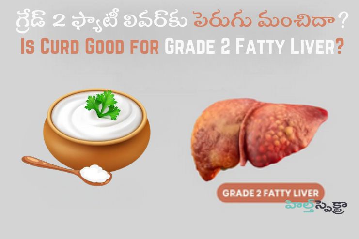 Is Curd Good for Grade 2 Fatty Liver