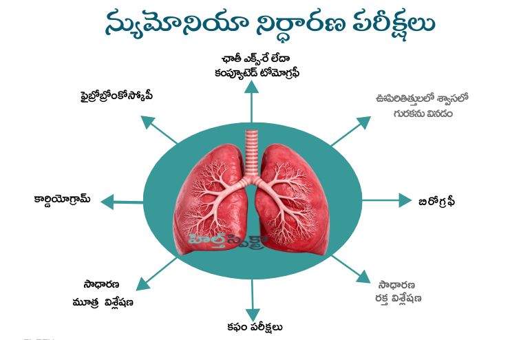 Pneumonia Diagnosis