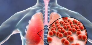 న్యుమోనియా లక్షణాలను సకాలంలో గుర్తించడం ఎలా.? - Identifying Pneumonia Warning Signs for Early Treatment Pneumonia symptoms_ early detection, proper treatment and prevention