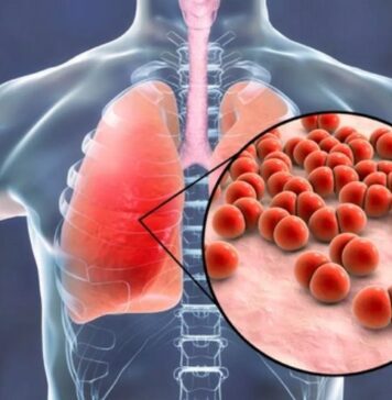 న్యుమోనియా లక్షణాలను సకాలంలో గుర్తించడం ఎలా.? Pneumonia symptoms_ early detection, proper treatment and prevention