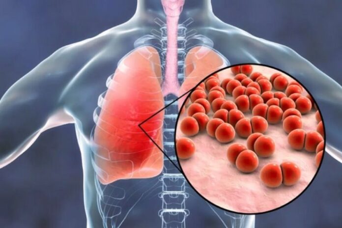 Pneumonia symptoms_ early detection, proper treatment and prevention