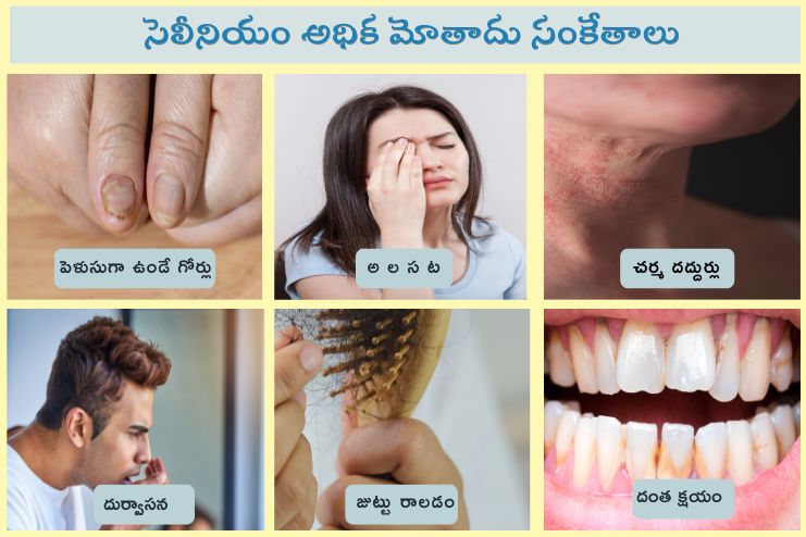 Potential risks of Selenium