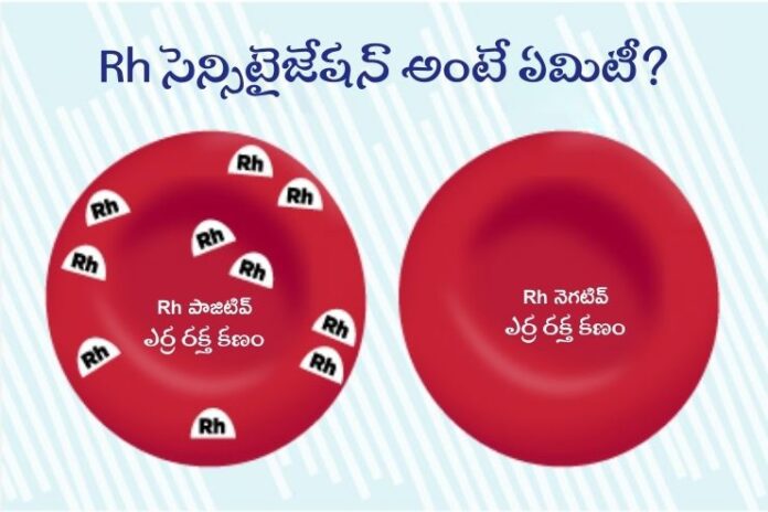Rh Sensitization During Pregnancy Rh Sensitization During Pregnancy