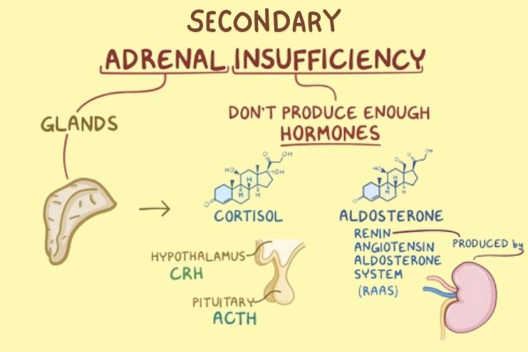 Secondary adrenal insufficiency