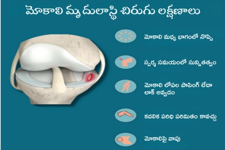 Symptoms of a Knee Cartilage Tear