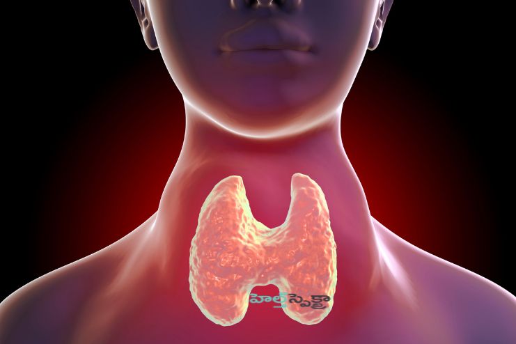 Thyroid disease