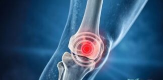 మోకాలి కార్టిలేజ్ చిరిగితే కనిపించే లక్షణాలు, చికిత్స ఇలా..! - Torn Cartilage in the Knee: Symptoms and Treatment Torn Cartilage in the Knee