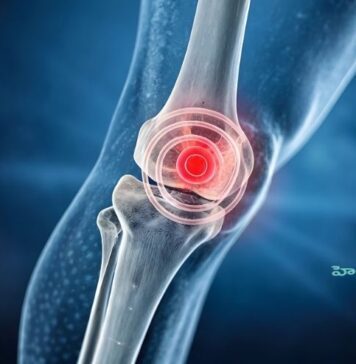 మోకాలి కార్టిలేజ్ చిరిగితే కనిపించే లక్షణాలు, చికిత్స ఇలా..! Torn Cartilage in the Knee