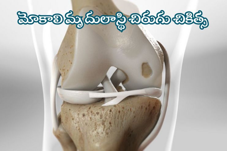 Treatments of Cartilage Injury
