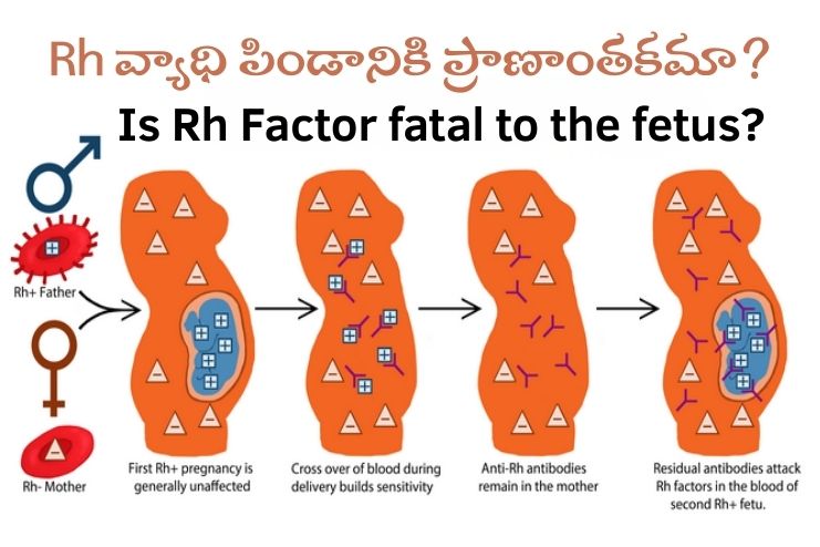 When is the fetus at risk