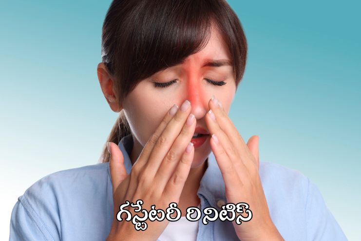 Gustatory rhinitis 2