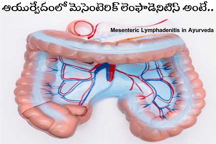 Mesenteric Lymphadenitis in Ayurveda