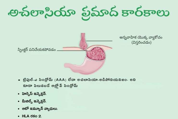 Risk factors of Achalasia