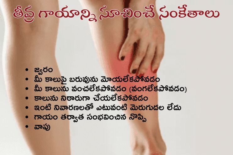 Signs that indicate serious injury