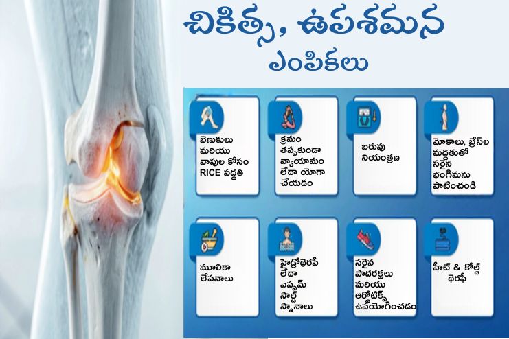 Treatment and Relief Options