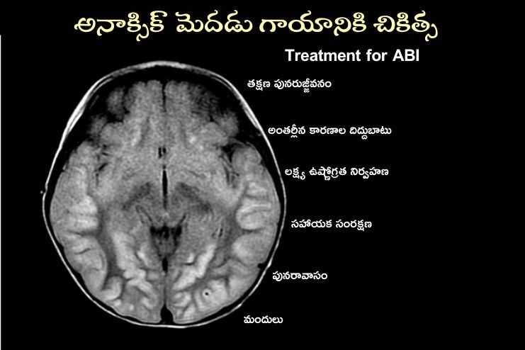 What is the treatment for ABI