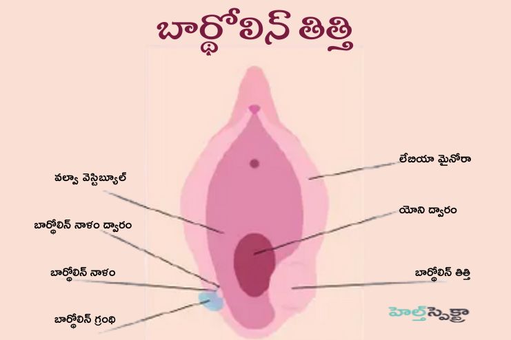 Bartholin's cyst text