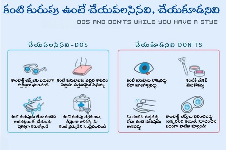 How to prevent styes 2