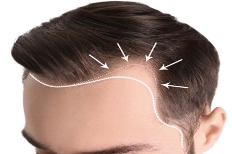 What to know about hair loss