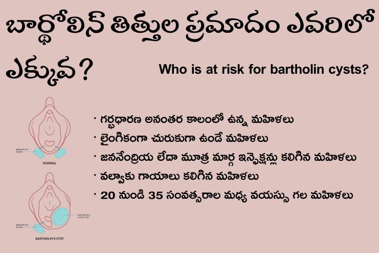 Who is at risk for bartholin cysts