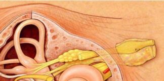 అకౌస్టిక్ న్యూరోమా: కారణాలు, లక్షణాలు మరియు చికిత్స - Acoustic Neuroma: Symptoms, Causes, and Treatment Acoustic Neuroma_ Symptoms, Causes, and Treatment