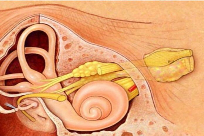 Acoustic Neuroma_ Symptoms, Causes, and Treatment