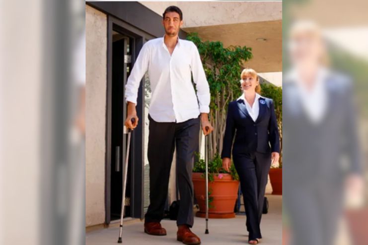 Acromegaly vs. Gigantism