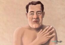 అక్రోమెగలీ: కారణాలు, లక్షణాలు మరియు చికిత్స Acromegaly_ Causes, Symptoms and Treatment