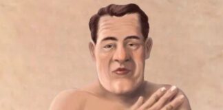 అక్రోమెగలీ: కారణాలు, లక్షణాలు మరియు చికిత్స - Acromegaly: Causes, Symptoms and Treatment Acromegaly_ Causes, Symptoms and Treatment