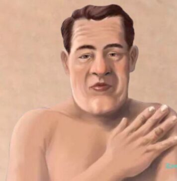 అక్రోమెగలీ: కారణాలు, లక్షణాలు మరియు చికిత్స Acromegaly_ Causes, Symptoms and Treatment