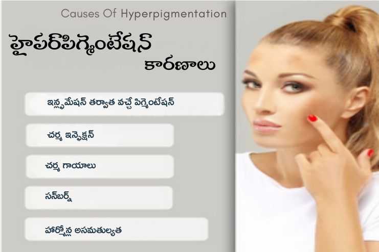 Causes of Hyper-pigmentation