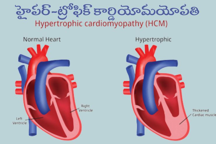Getting winded more easily than expected