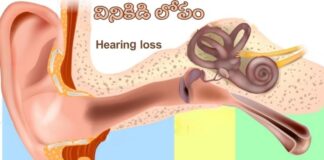 వినికిడి లోపం: కారణాలు, లక్షణాలు మరియు చికిత్స - Hearing Loss: Causes, Symptoms and Treatment Hearing Loss_ Causes, Symptoms and Treatment
