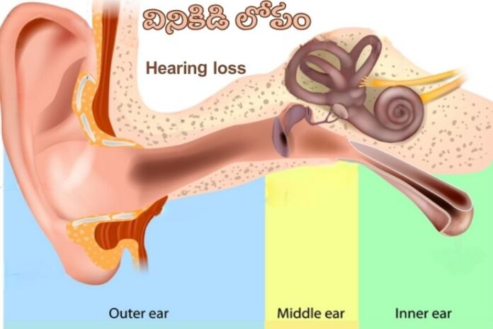 Hearing Loss_ Causes, Symptoms and Treatment
